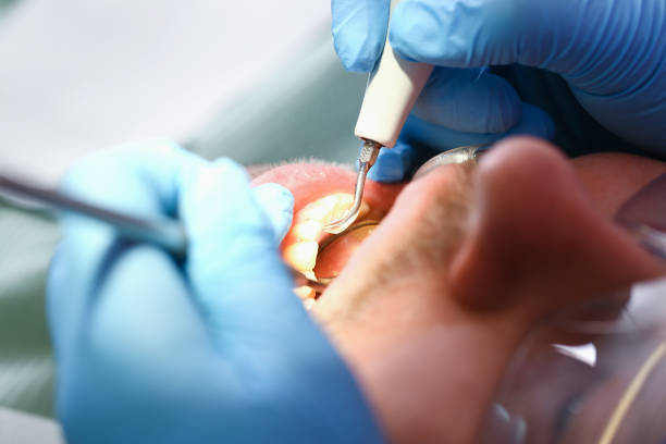 Best Emergency Dental Care for Abscessed Tooth in La Harpe, IL